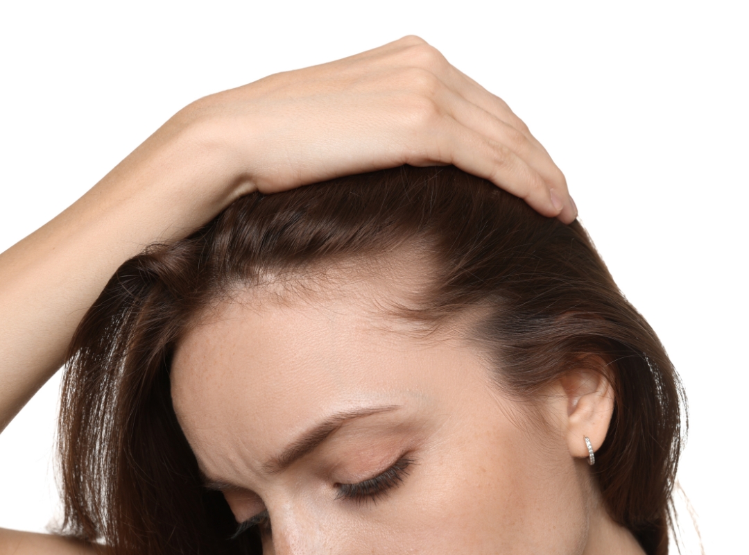 Imagem do post: Minoxidil Oral: Por Que Ele Pode Ser Uma Opção Para Quem Não Se Adapta Ao Tratamento Tópico?