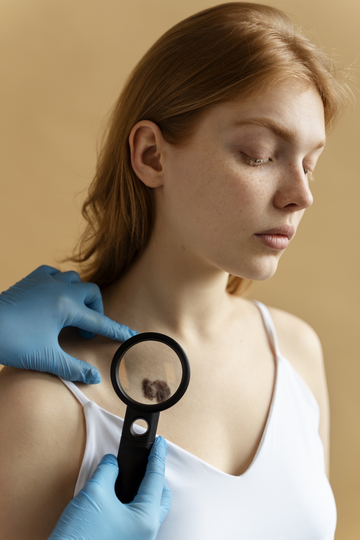 Foto de Biópsia de Pele