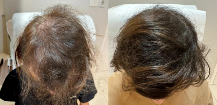 Foto mostrando antes e depois de cabelo