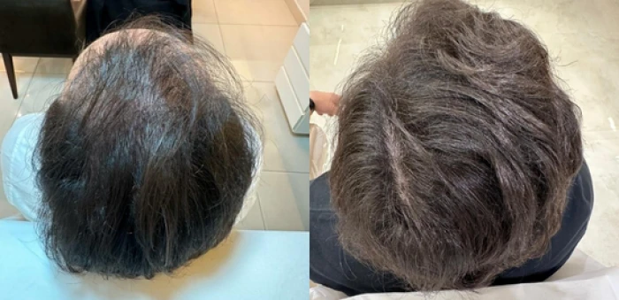 Foto mostrando antes e depois de cabelo