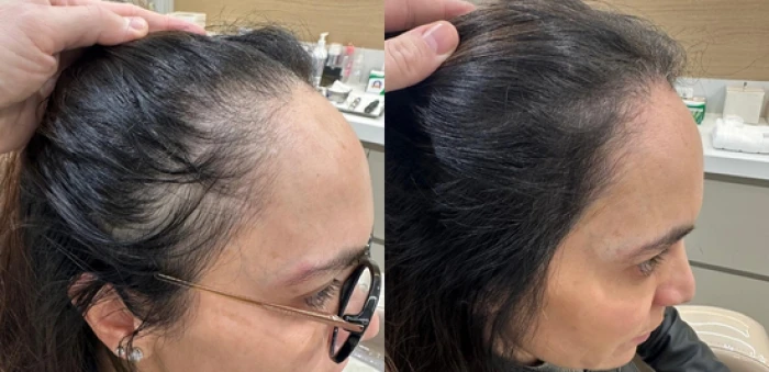 Foto mostrando antes e depois de cabelo