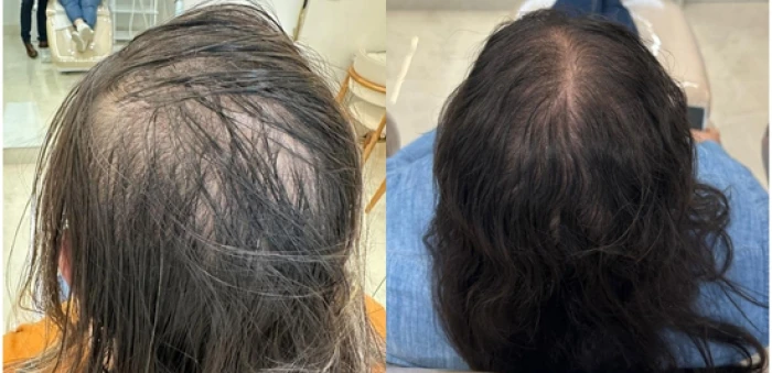 Foto mostrando antes e depois de cabelo