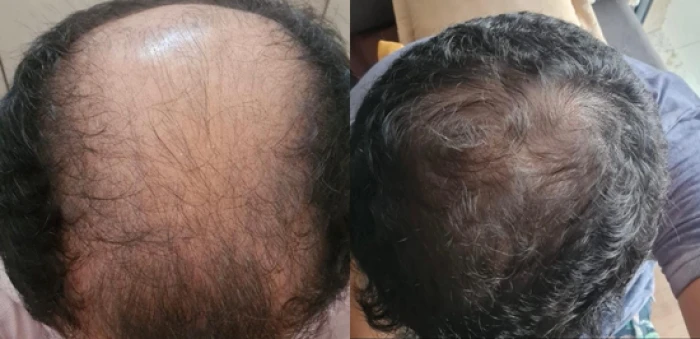Foto mostrando antes e depois de cabelo