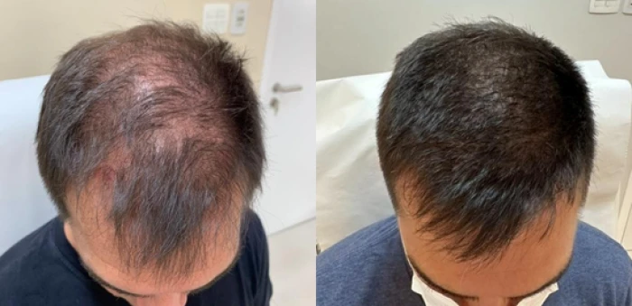 Foto mostrando antes e depois de cabelo