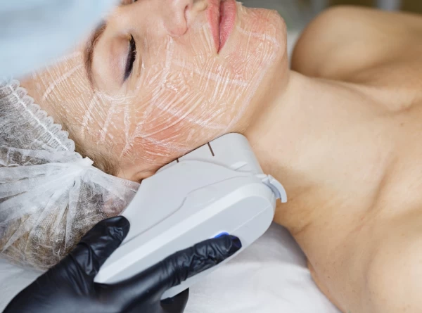 Imagem do post Pele Sensível Pode Fazer Laser? O Que Você Precisa Saber Antes