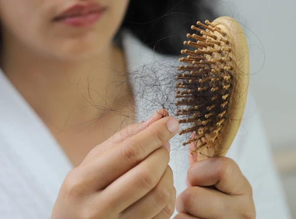 Imagem do post Queda de Cabelo: Por Que o MMP Funciona Onde Cremes Não Funcionam