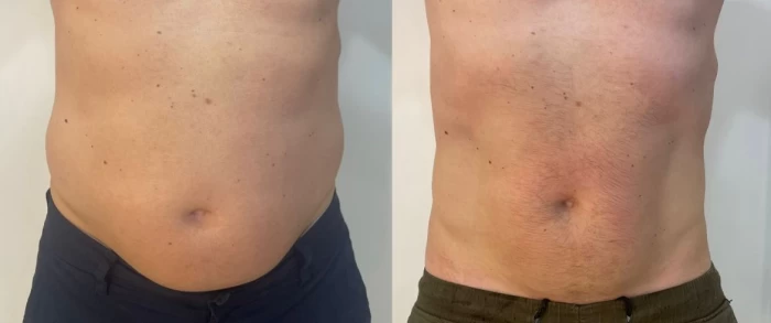 Foto mostrando antes e depois de cabelo