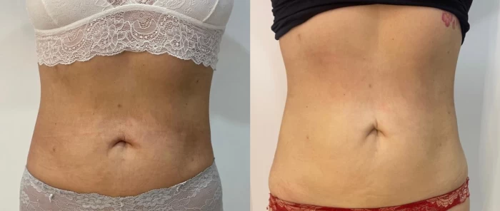 Foto mostrando antes e depois de cabelo