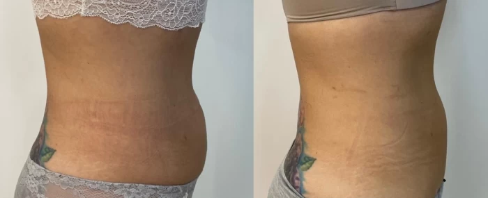 Foto mostrando antes e depois de cabelo