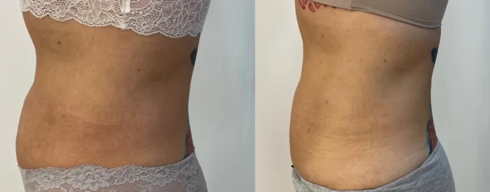 Foto mostrando antes e depois de cabelo