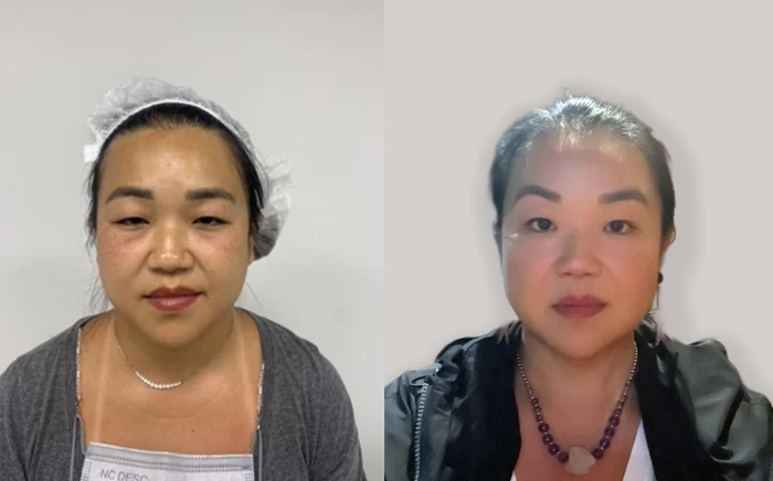 Foto mostrando antes e depois de cabelo