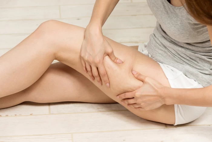 Imagem do serviço Celulite