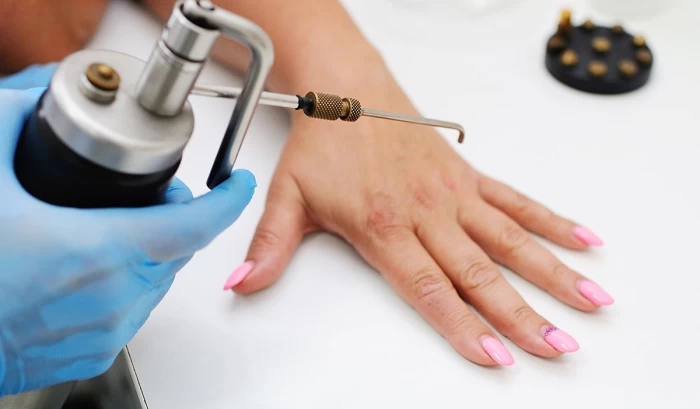 Imagem do serviço Criocirurgia