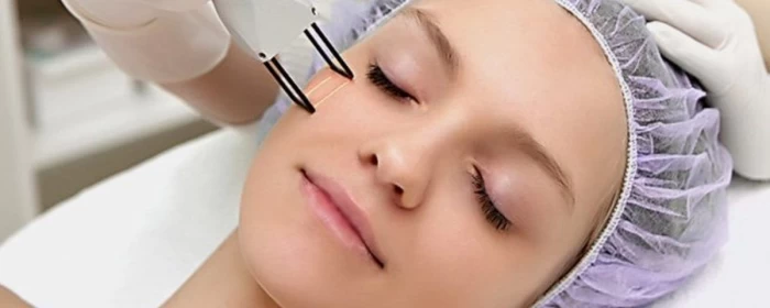 Imagem do serviço Laser de CO2 Fracionado