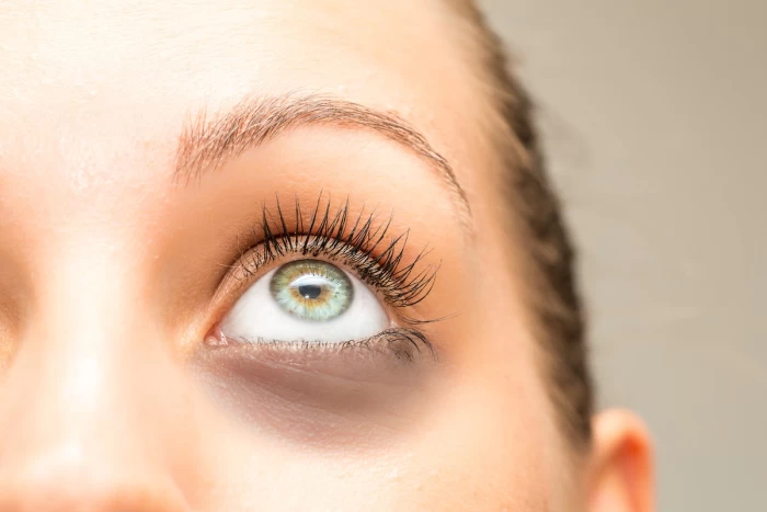 Imagem do serviço Olheiras