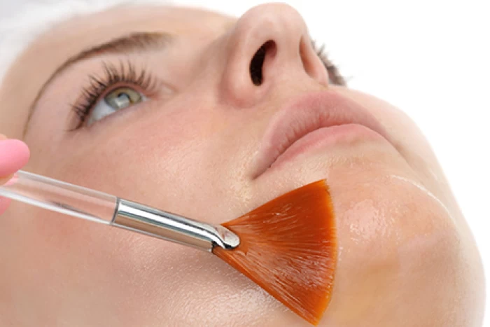 Imagem do serviço Peeling Químico