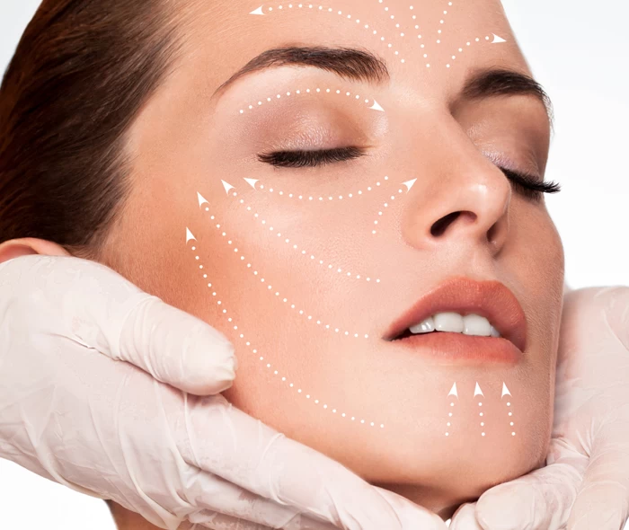 Imagem do serviço Hidroxiapatita de Cálcio (Radiesse®)