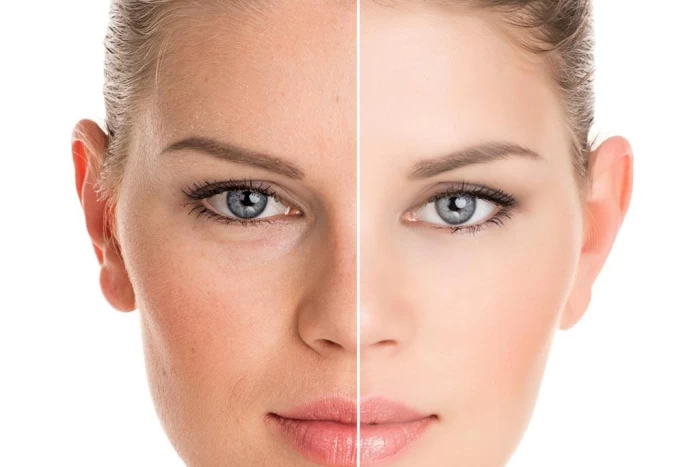 Imagem do serviço Hidratação Injetável (Skinbooster)